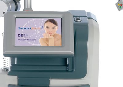 SMART XIDE 0035